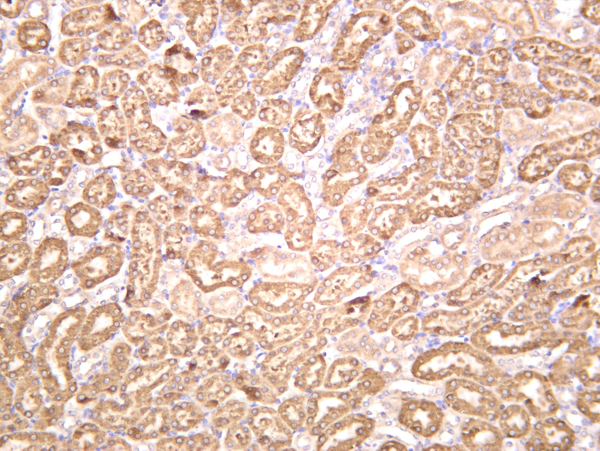Mouse kidney was stained with anti-Src (PT0588R) rabbit antibody