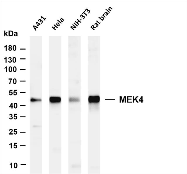 Various whole cell lysates were separated by 4-20% SDS-PAGE, and the membrane was blotted with anti-MEK4 (PT0589R) antibody. The HRP-conjugated Goat anti-Rabbit IgG(H + L) antibody was used to detect the antibody.