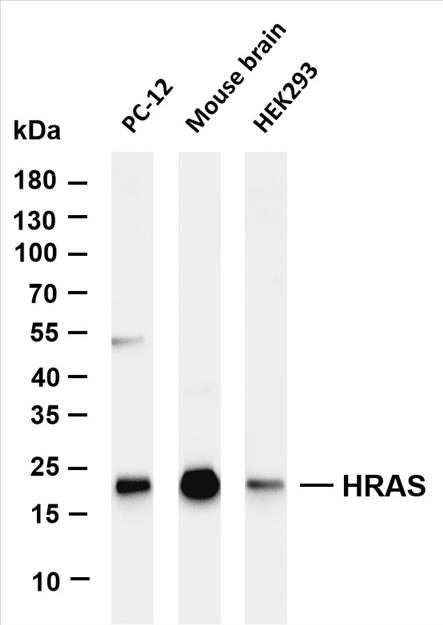Various whole cell lysates were separated by 4-20% SDS-PAGE, and the membrane was blotted with anti-HRAS (PT0590R) antibody. The HRP-conjugated Goat anti-Rabbit IgG(H + L) antibody was used to detect the antibody.
