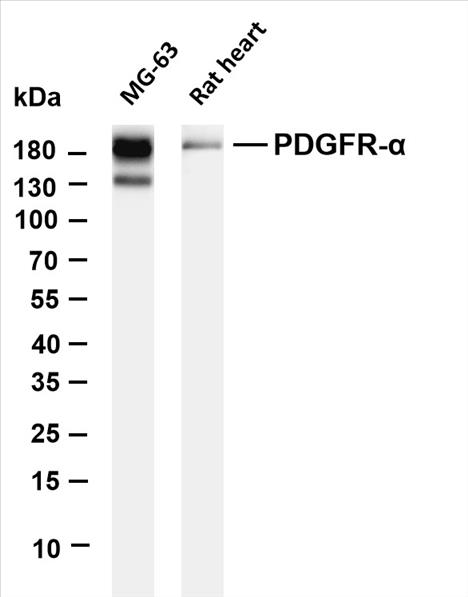 Various whole cell lysates were separated by 4-20% SDS-PAGE, and the membrane was blotted with anti-PDGFR-Î± (PT0591R) antibody. The HRP-conjugated Goat anti-Rabbit IgG(H + L) antibody was used to detect the antibody.