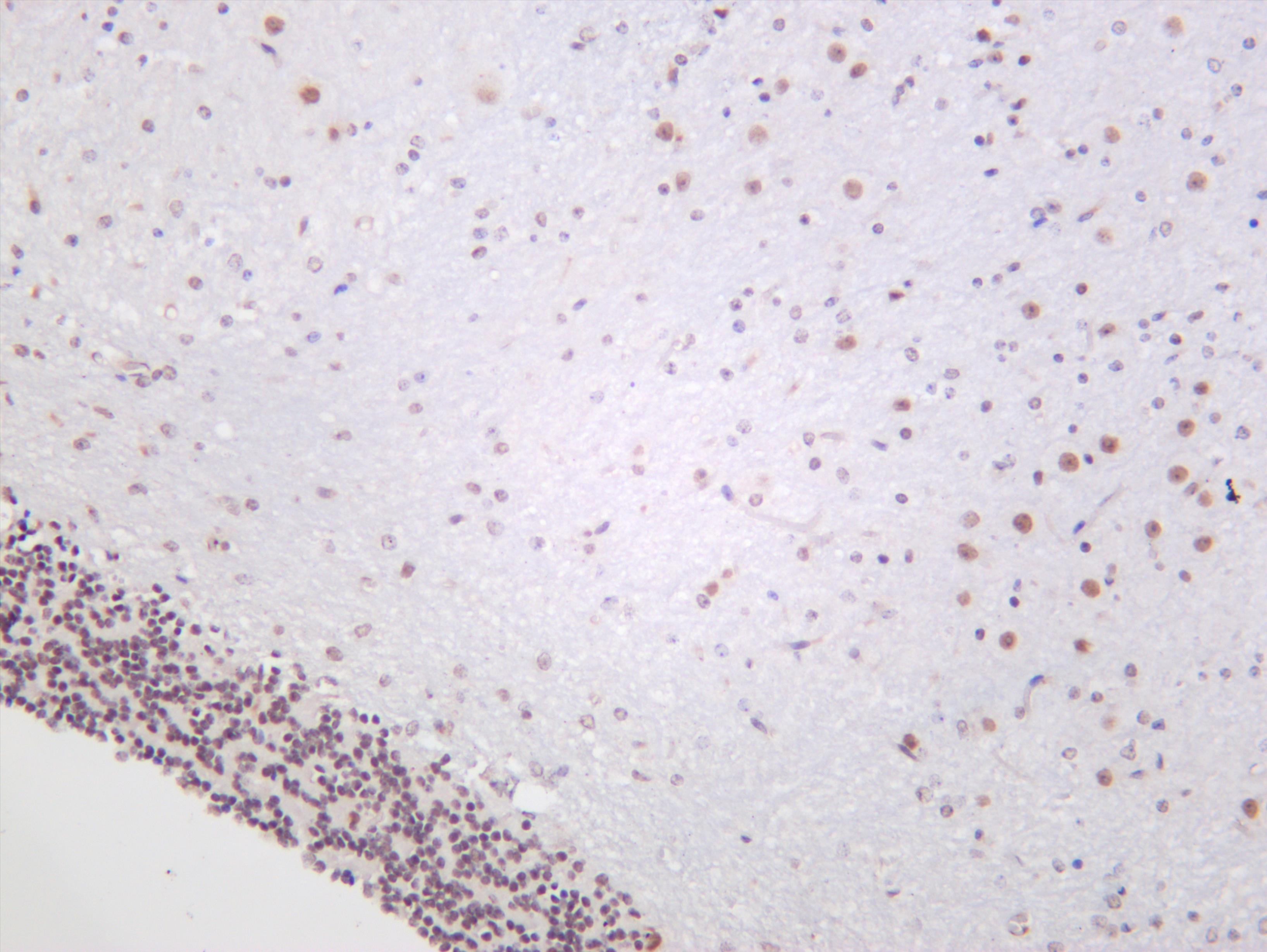 Mouse brain was stained with anti-HDAC4 (PT0600R) rabbit antibody