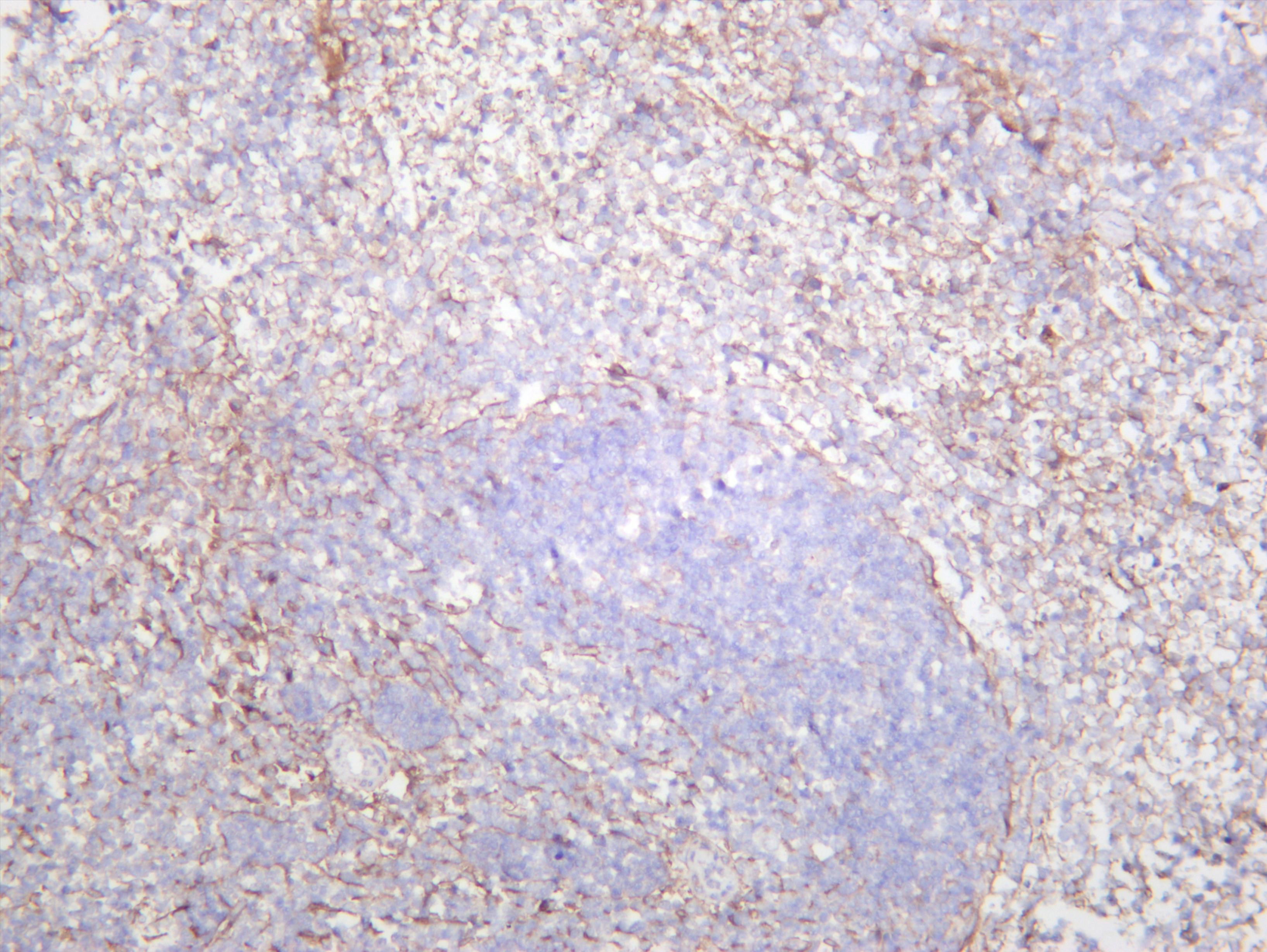 Mouse spleen was stained with anti-PDGFR-Î² (PT0604R) rabbit antibody