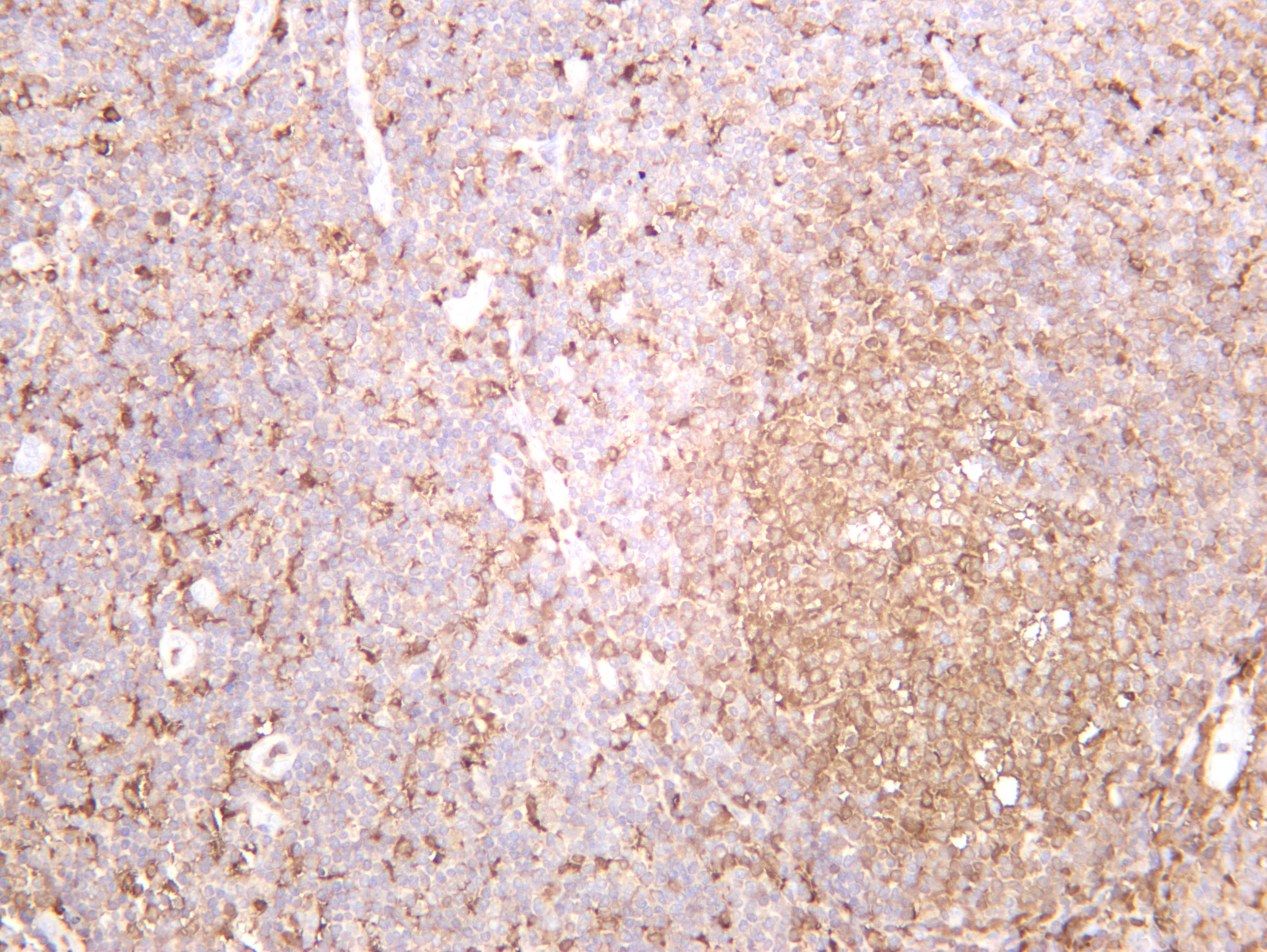 Human tonsil was stained with anti-PKC Î´ (PT0605R) rabbit antibody