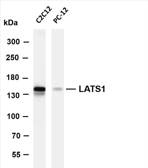 Various whole cell lysates were separated by 4-8% SDS-PAGE, and the membrane was blotted with anti-LATS1 (PT0609R) antibody. The HRP-conjugated Goat anti-Rabbit IgG(H + L) antibody was used to detect the antibody.