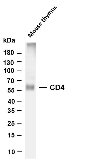 Various whole cell lysates were separated by 4-20% SDS-PAGE, and the membrane was blotted with anti-CD4 (PT0610R) antibody. The HRP-conjugated Goat anti-Rabbit IgG(H + L) antibody was used to detect the antibody.