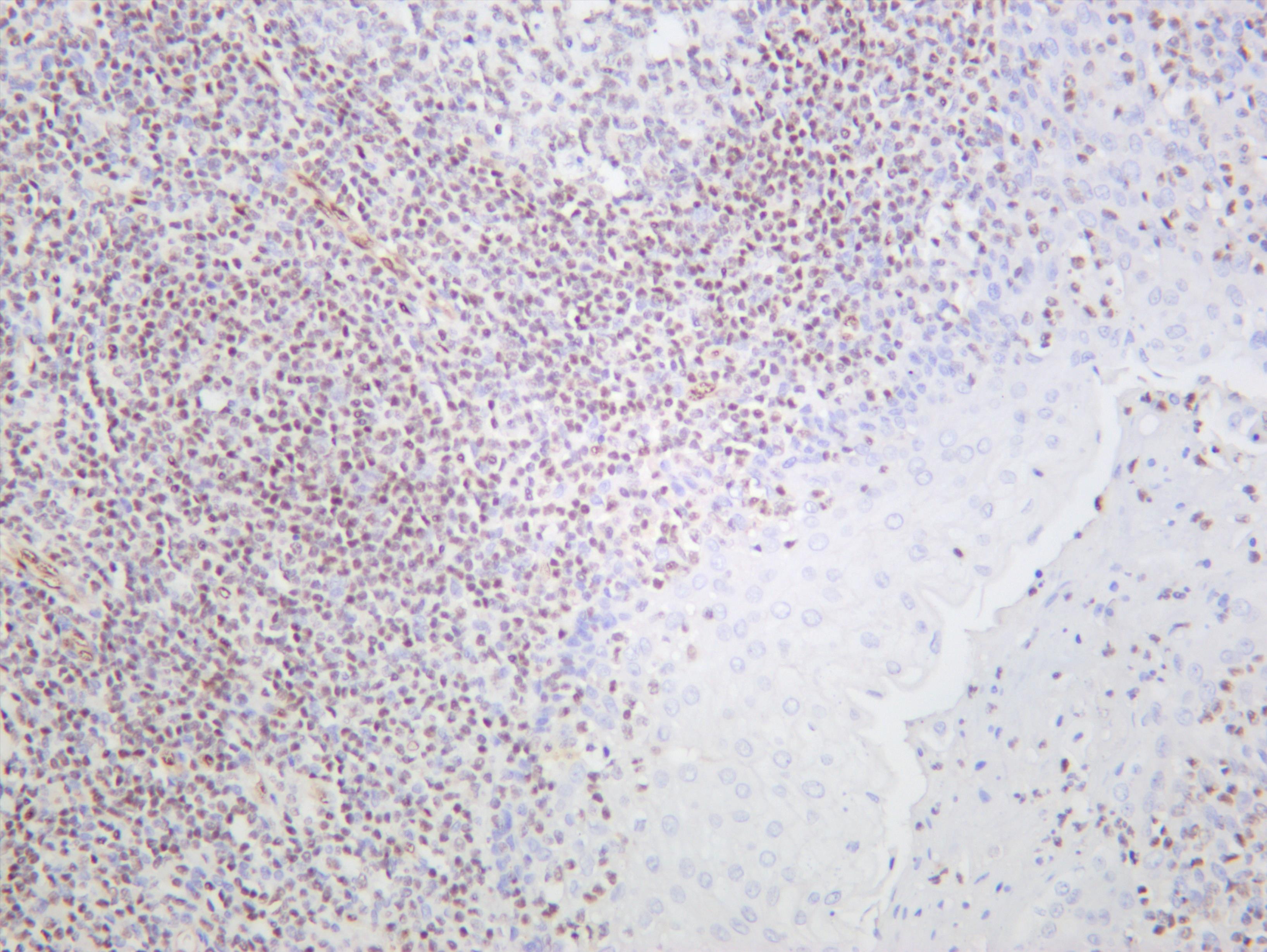 Human tonsil was stained with anti-ERG (PT0615R) rabbit antibody