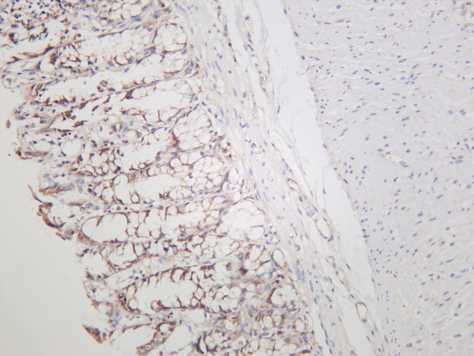 Rat colon was stained with anti-Met (PT0619R) rabbit antibody