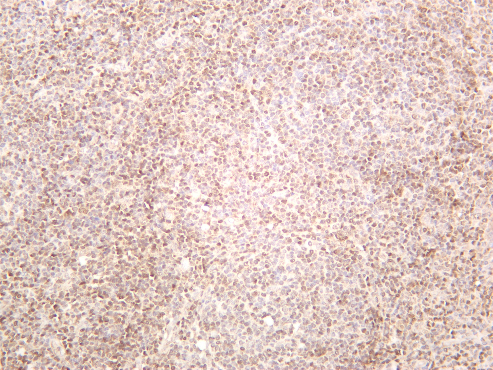 Human tonsil was stained with anti-STAT5A (PT0622R) rabbit antibody
