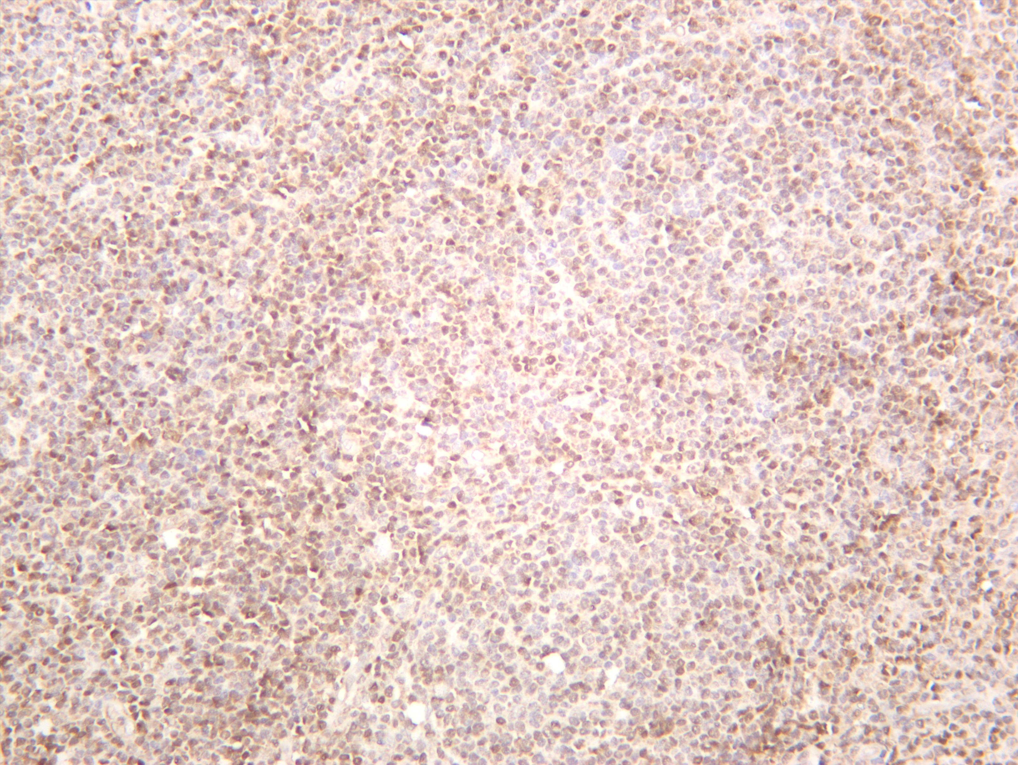 Human tonsil was stained with anti-STAT5A (PT0622R) rabbit antibody