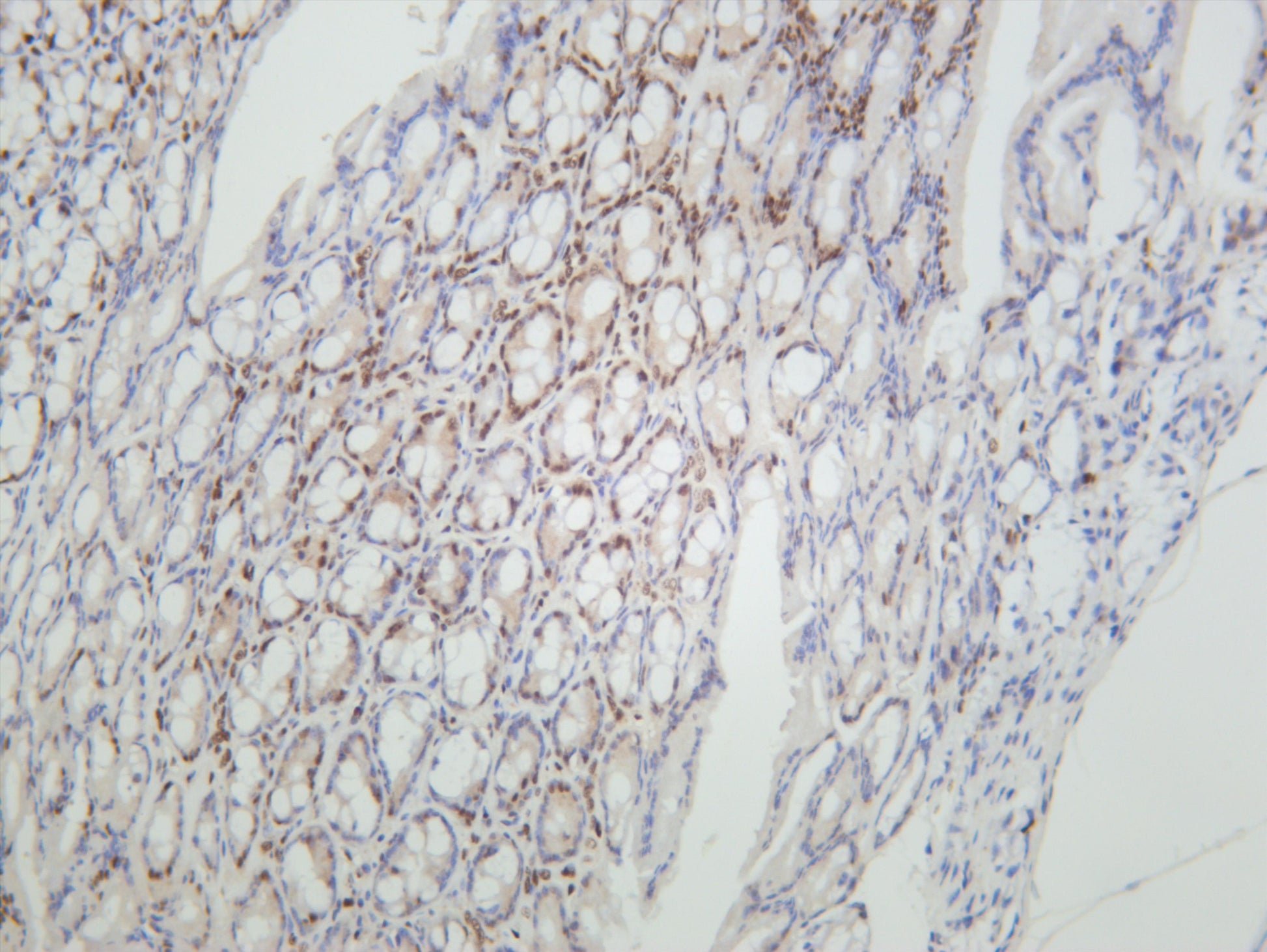 Mouse colon was stained with anti-Histone H3 (Acetyl Lys9) (PT0624R) rabbit antibody
