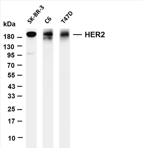Various whole cell lysates were separated by 4-20% SDS-PAGE, and the membrane was blotted with anti-HER2 (PT0626R) antibody. The HRP-conjugated Goat anti-Rabbit IgG(H + L) antibody was used to detect the antibody.