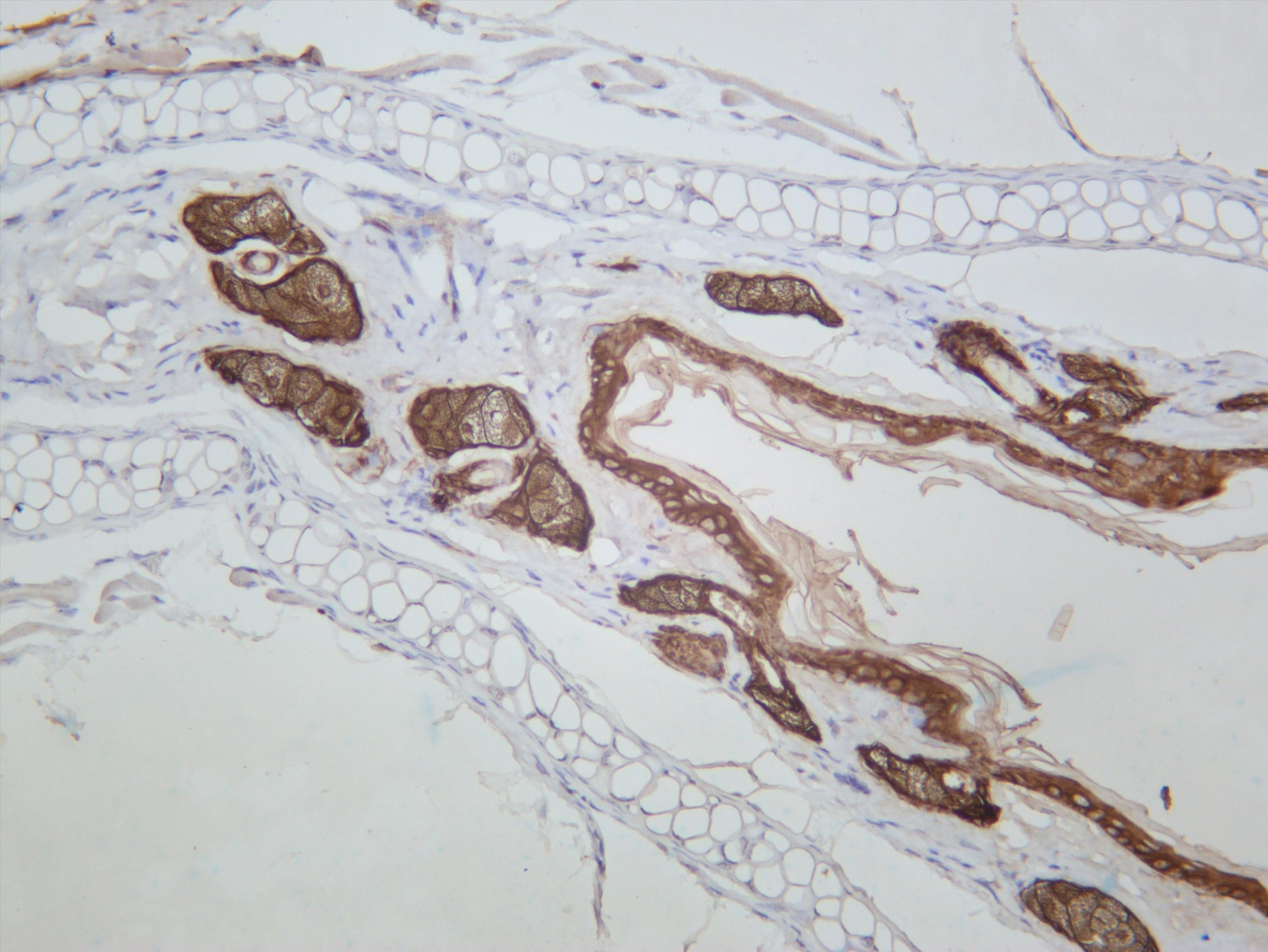Mouse skin was stained with anti-Cytokeratin 14 (PT0630R) rabbit antibody