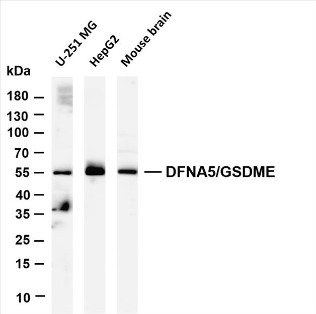 Various whole cell lysates were separated by 4-20% SDS-PAGE, and the membrane was blotted with anti-DFNA5/GSDME (PT0634R) antibody. The HRP-conjugated Goat anti-Rabbit IgG(H + L) antibody was used to detect the antibody.