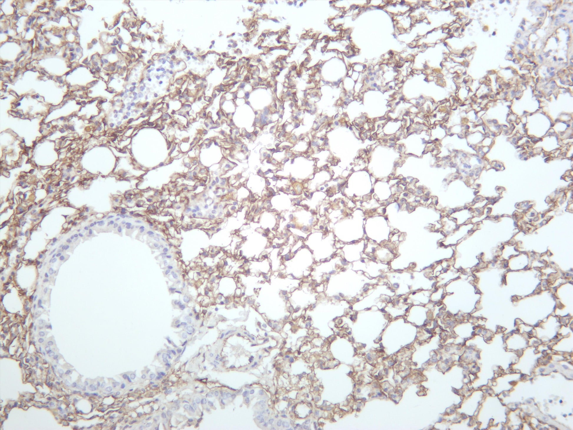 Mosue lung was stained with anti-Podoplanin (PT0638R) rabbit antibody