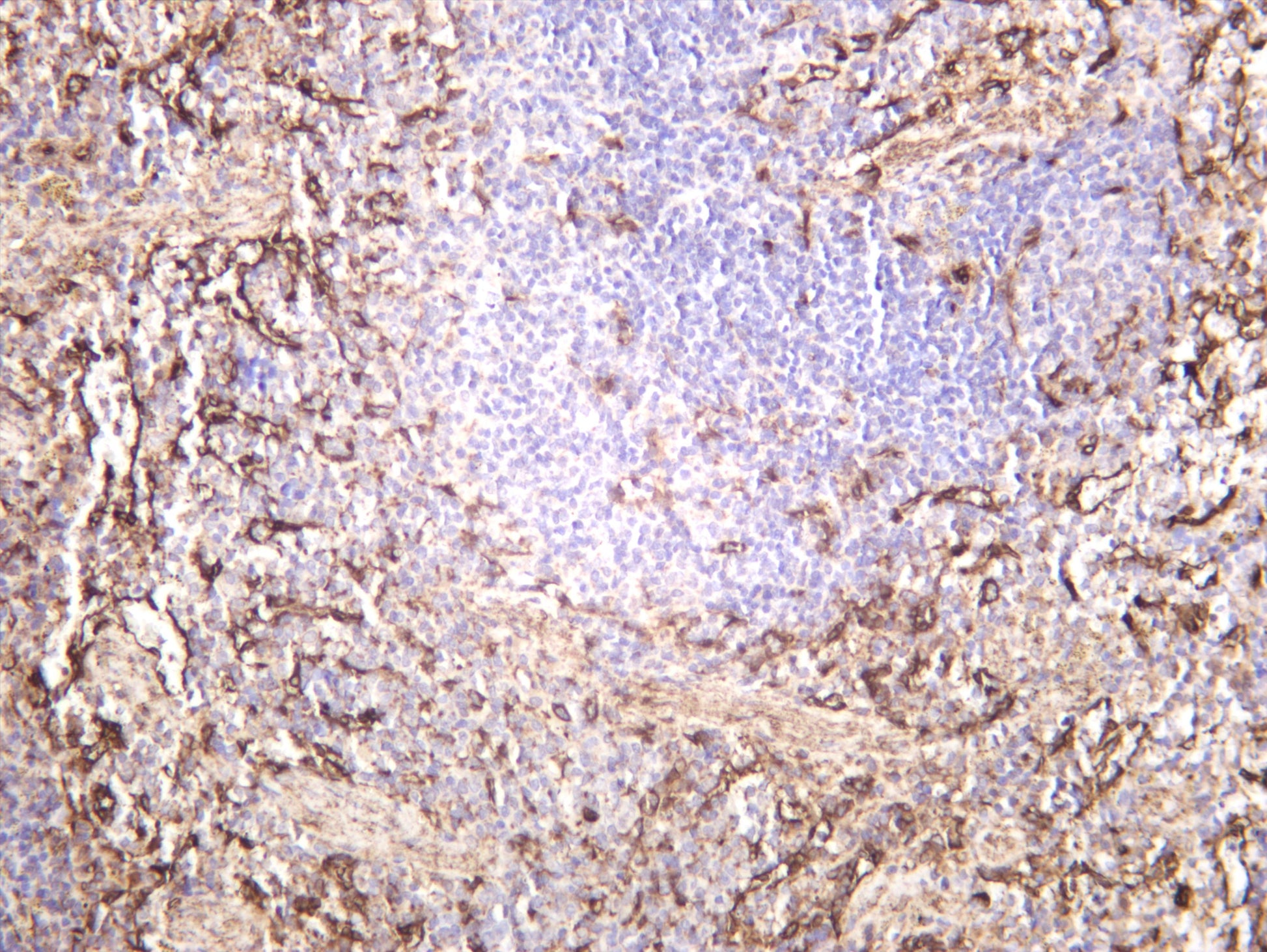 Mouse spleen was stained with anti-ZO1 (PT0639R) rabbit antibody
