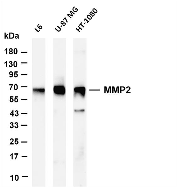 Various whole cell lysates were separated by 4-20% SDS-PAGE, and the membrane was blotted with anti-MMP2 (PT0642R) antibody. The HRP-conjugated Goat anti-Rabbit IgG(H + L) antibody was used to detect the antibody.