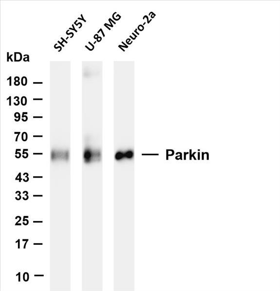 Various whole cell lysates were separated by 4-20% SDS-PAGE, and the membrane was blotted with anti-Parkin (PT0659R) antibody. The HRP-conjugated Goat anti-Rabbit IgG(H + L) antibody was used to detect the antibody.