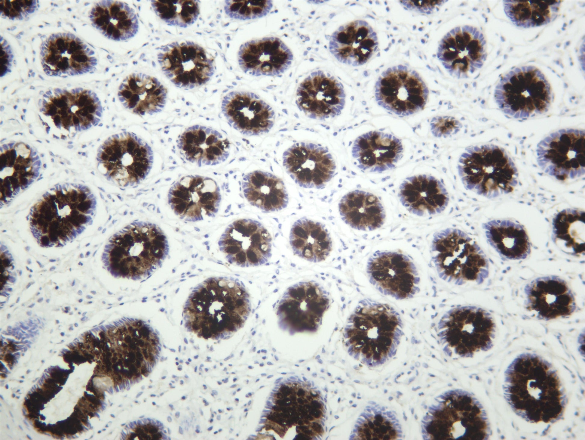 Human colon was stained with anti-MUC2 (PT0660R) rabbit antibody