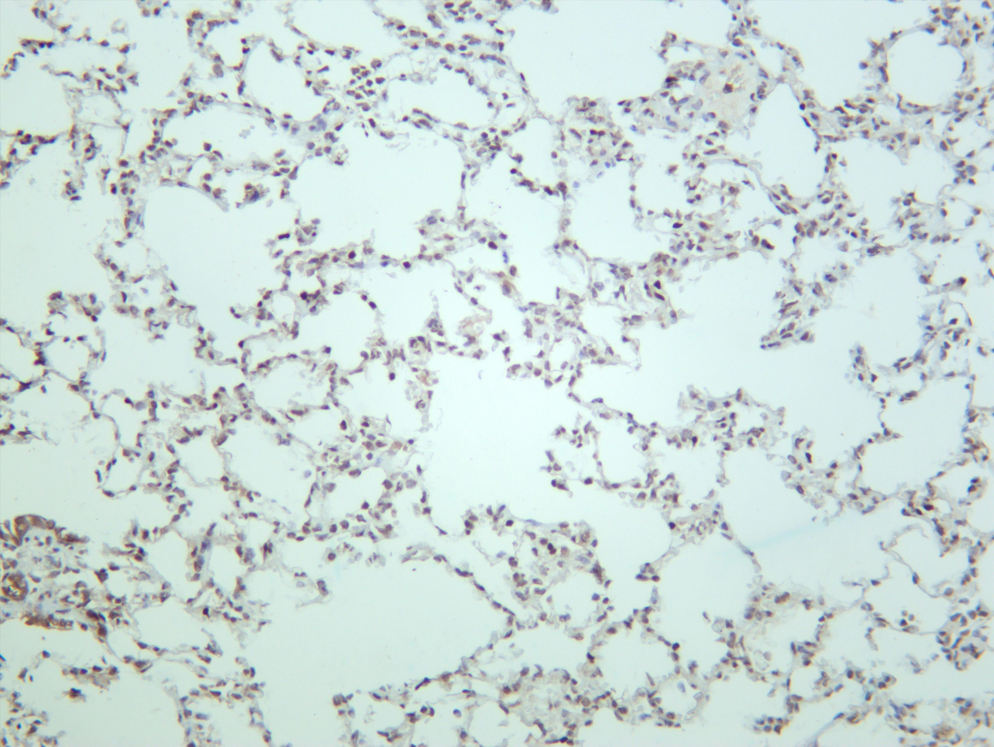 Rat lung was stained with anti-TCF7 (PT0663R) rabbit antibody