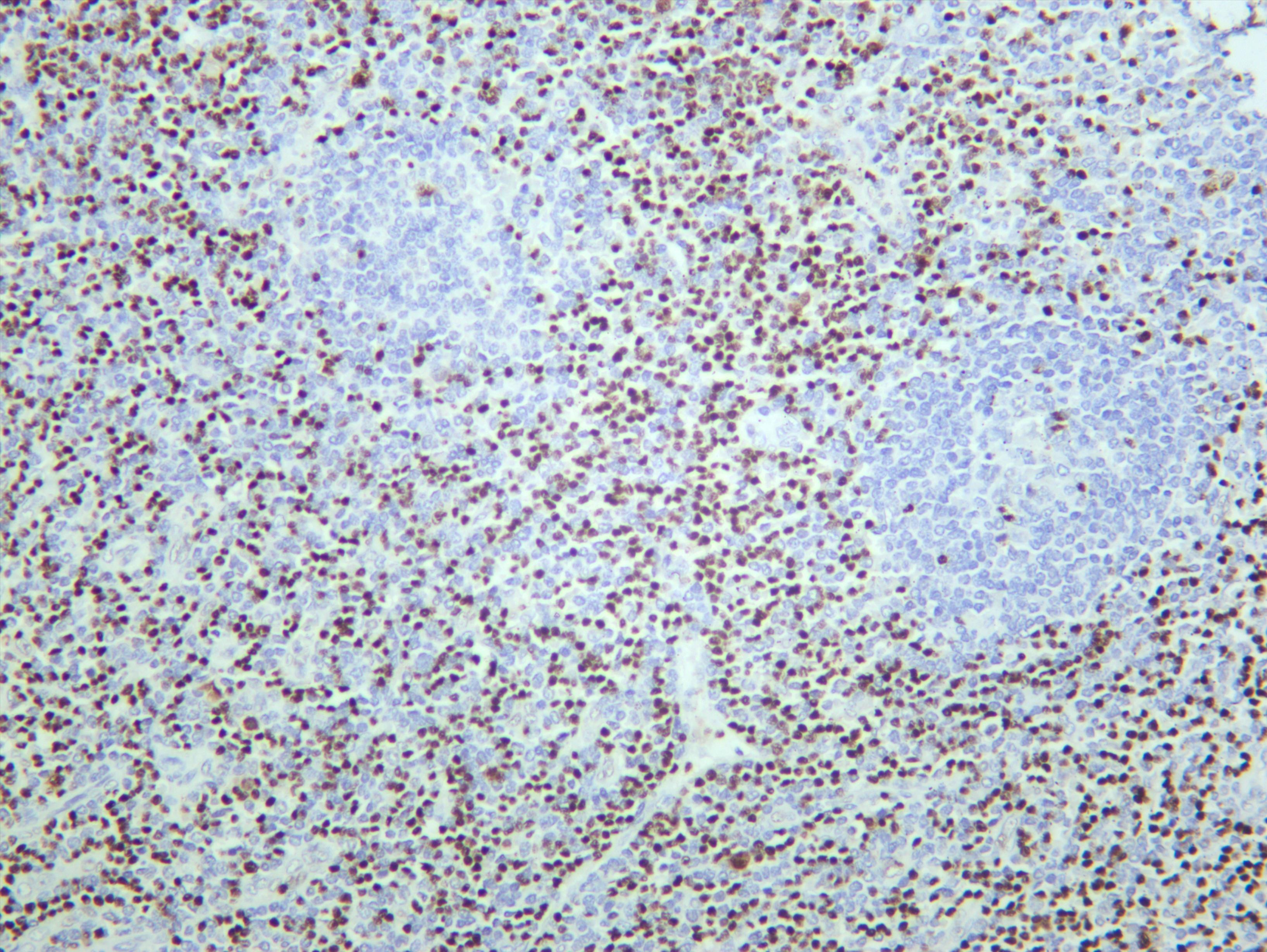 Human tonsil was stained with anti-LEF1 (PT0669R) rabbit antibody