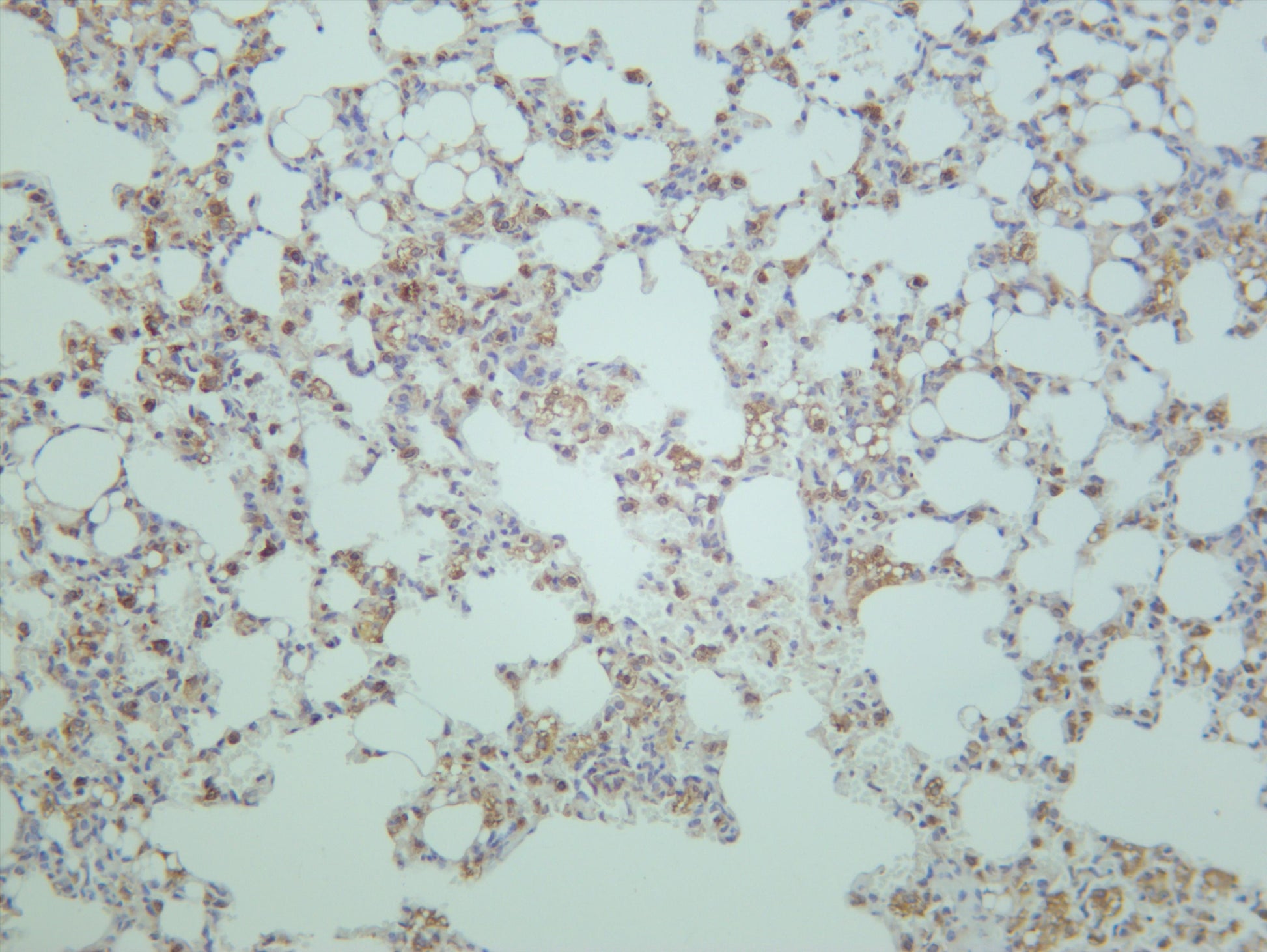 Mouse lung was stained with anti-Rictor (PT0671R) rabbit antibody