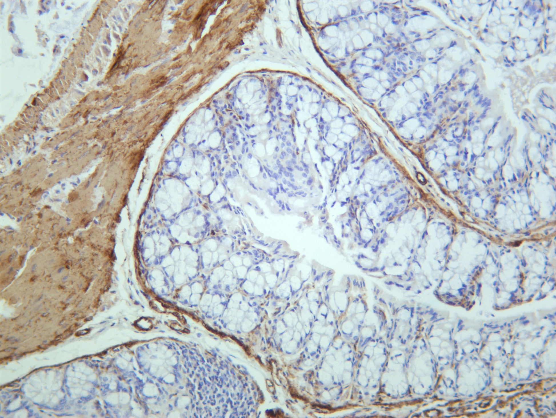 Mouse colon was stained with anti-MYL9 (PT0672R) rabbit antibody