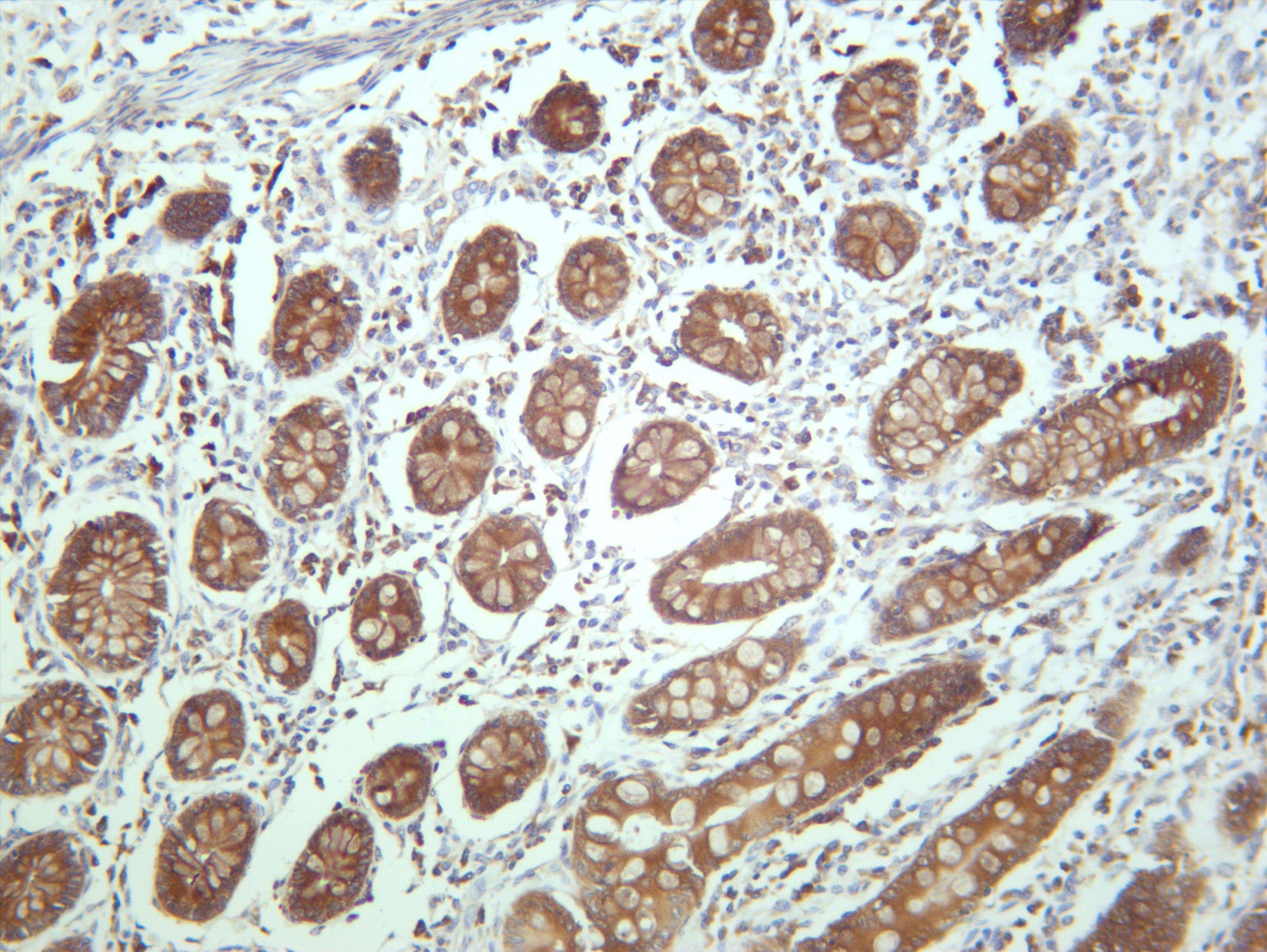 Human colon was stained with anti-p90RSK (PT0673R) rabbit antibody
