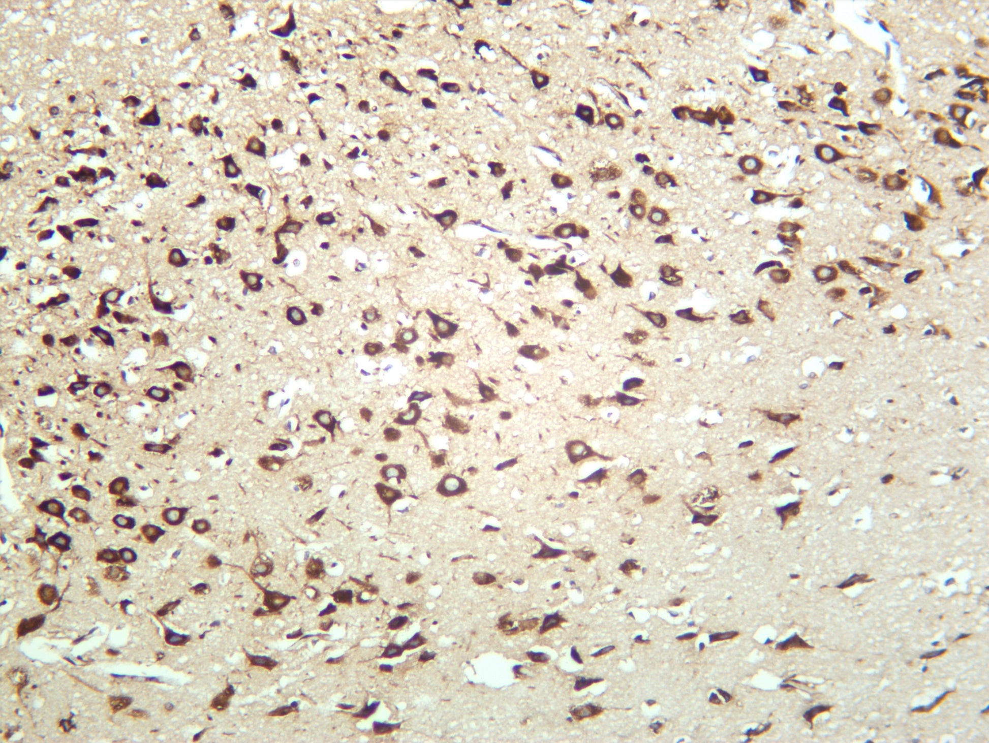 Rat brain was stained with anti-RPS6 (PT0676R) rabbit antibody