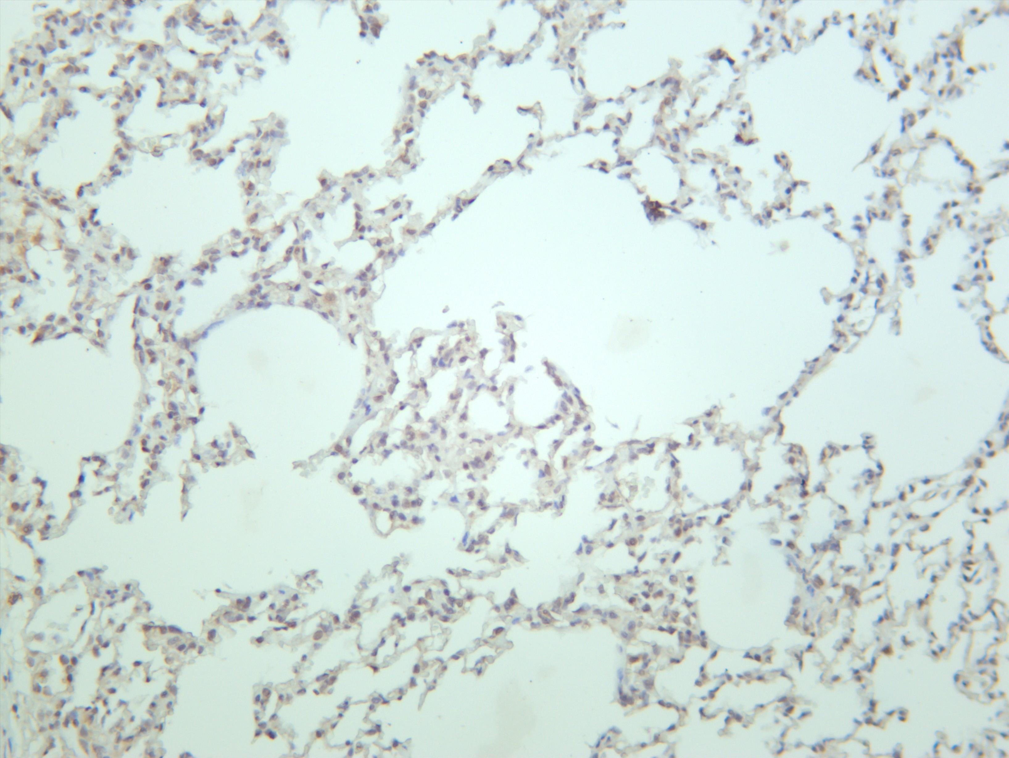 Rat lung was stained with anti-MDM2 (PT0681R) rabbit antibody