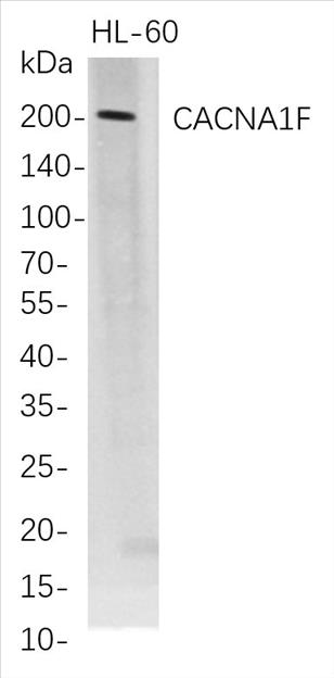 Western Blot analysis of HL-60 whole cell lysates were separated by 4-20% SDS-PAGE, and the membrane was blotted with anti-CACNA1F rabbit mAb. The HRP-conjugated Goat anti-Rabbit IgG(H + L) antibody was used to detect the antibody.