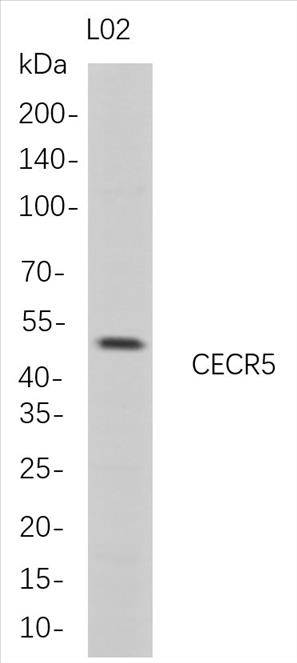 Western Blot analysis of L02 whole cell lysates were separated by 4-20% SDS-PAGE, and the membrane was blotted with anti-CECR5 rabbit mAb. The HRP-conjugated Goat anti-Rabbit IgG(H + L) antibody was used to detect the antibody.