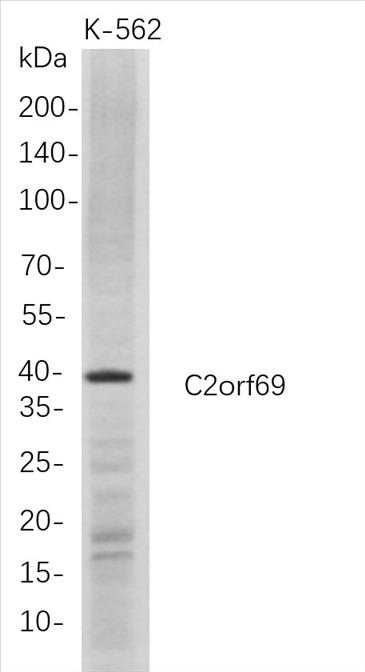 Western Blot analysis of K-562 whole cell lysates were separated by 4-20% SDS-PAGE, and the membrane was blotted with anti-C2orf69 rabbit mAb. The HRP-conjugated Goat anti-Rabbit IgG(H + L) antibody was used to detect the antibody.
