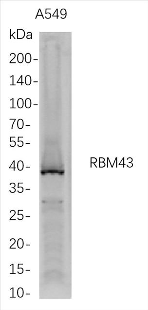 Western Blot analysis of A549 whole cell lysates were separated by 4-20% SDS-PAGE, and the membrane was blotted with anti-RBM43 rabbit mAb. The HRP-conjugated Goat anti-Rabbit IgG(H + L) antibody was used to detect the antibody.