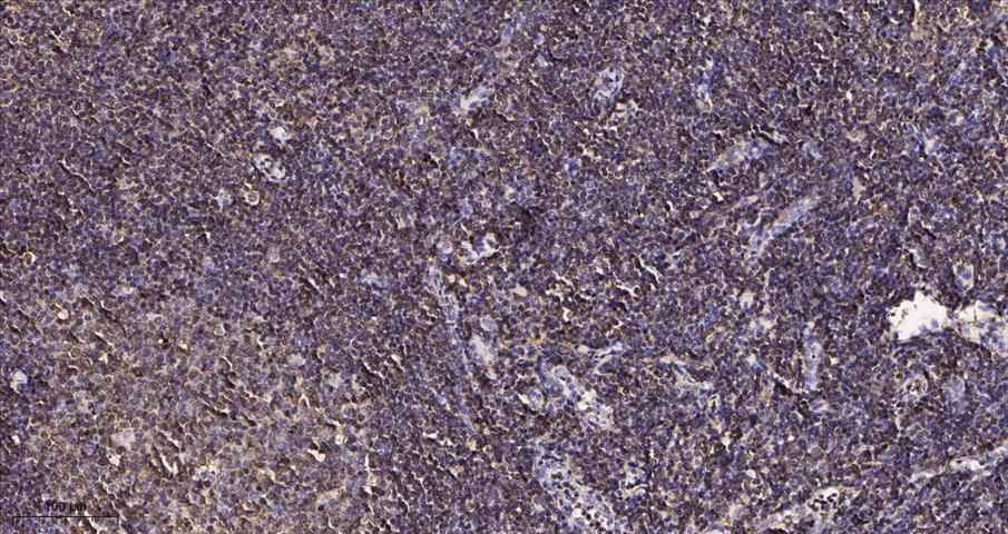 Immunohistochemical analysis of paraffin-embedded human tonsil tissue. 1,primary Antibody was diluted at 1:200(4Â°C,overnight). 2, EDTA pH 9.0 was used for antibody retrieval(>98Â°C,20min). 3,Secondary antibody was diluted at 1:200(room tempeRature, 30min).