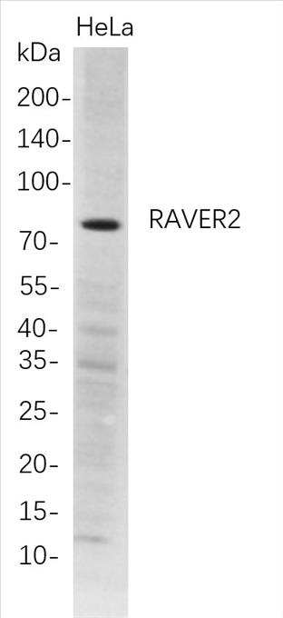 Western Blot analysis of HeLa whole cell lysates were separated by 4-20% SDS-PAGE, and the membrane was blotted with anti-RAVER2 rabbit mAb. The HRP-conjugated Goat anti-Rabbit IgG(H + L) antibody was used to detect the antibody.