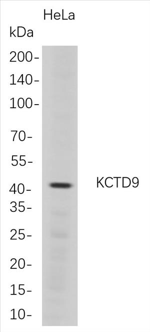 Western Blot analysis of HeLa whole cell lysates were separated by 4-20% SDS-PAGE, and the membrane was blotted with anti-KCTD9 rabbit mAb. The HRP-conjugated Goat anti-Rabbit IgG(H + L) antibody was used to detect the antibody.