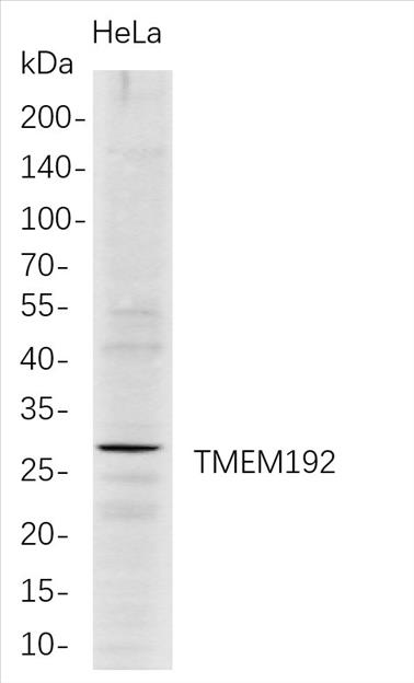 Western Blot analysis of HeLa whole cell lysates were separated by 4-20% SDS-PAGE, and the membrane was blotted with anti-TMEM192 rabbit mAb. The HRP-conjugated Goat anti-Rabbit IgG(H + L) antibody was used to detect the antibody.