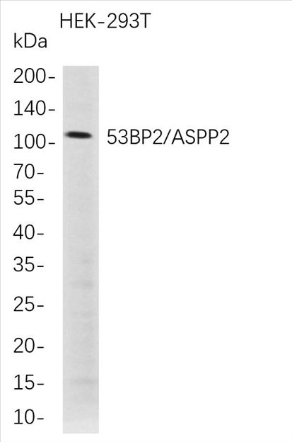 Western Blot analysis of HEK-293TÂ Â  whole cell lysates were separated by 4-20% SDS-PAGE, and the membrane was blotted with anti-53BP2/ASPP2 rabbit mAb. The HRP-conjugated Goat anti-Rabbit IgG(H + L) antibody was used to detect the antibody.