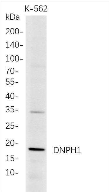 Western Blot analysis of K-562 whole cell lysates were separated by 4-20% SDS-PAGE, and the membrane was blotted with anti-DNPH1 rabbit mAb. The HRP-conjugated Goat anti-Rabbit IgG(H + L) antibody was used to detect the antibody.