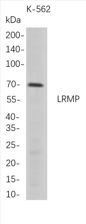 Western Blot analysis of K-562 whole cell lysates were separated by 4-20% SDS-PAGE, and the membrane was blotted with anti-LRMP rabbit mAb. The HRP-conjugated Goat anti-Rabbit IgG(H + L) antibody was used to detect the antibody.