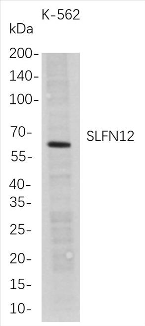 Western Blot analysis of K-562 whole cell lysates were separated by 4-20% SDS-PAGE, and the membrane was blotted with anti-SLFN12 rabbit mAb. The HRP-conjugated Goat anti-Rabbit IgG(H + L) antibody was used to detect the antibody.