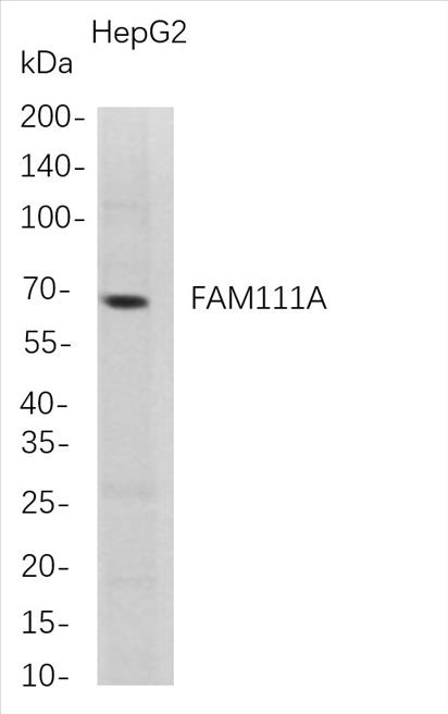 Western Blot analysis of HepG2 whole cell lysates were separated by 4-20% SDS-PAGE, and the membrane was blotted with anti-FAM111A rabbit mAb. The HRP-conjugated Goat anti-Rabbit IgG(H + L) antibody was used to detect the antibody.