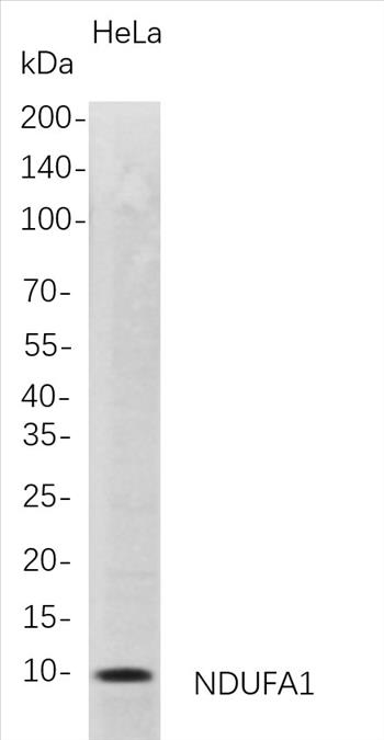 Western Blot analysis of HeLa whole cell lysates were separated by 4-20% SDS-PAGE, and the membrane was blotted with anti-NDUFA1 rabbit mAb. The HRP-conjugated Goat anti-Rabbit IgG(H + L) antibody was used to detect the antibody.