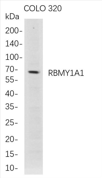 Western Blot analysis of COLO 320Â Â  whole cell lysates were separated by 4-20% SDS-PAGE, and the membrane was blotted with anti-RBMY1A1 rabbit mAb. The HRP-conjugated Goat anti-Rabbit IgG(H + L) antibody was used to detect the antibody.