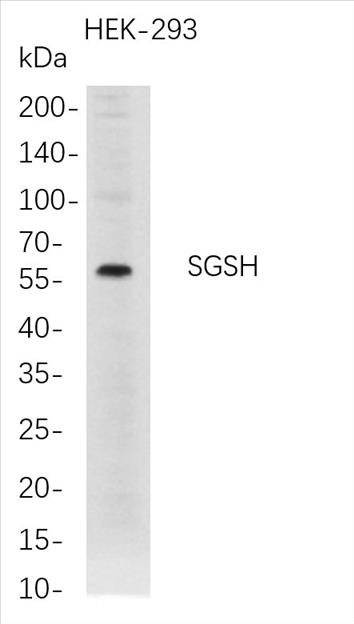 Western Blot analysis of HEK-293Â Â  whole cell lysates were separated by 4-20% SDS-PAGE, and the membrane was blotted with anti-SGSH rabbit mAb. The HRP-conjugated Goat anti-Rabbit IgG(H + L) antibody was used to detect the antibody.