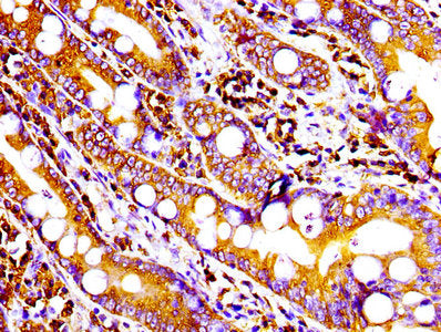 IHC image diluted at 1:100 and staining in paraffin-embedded human small intestine tissue performed on a Leica BondTM system. After dewaxing and hydration, antigen retrieval was mediated by high pressure in a citrate buffer (pH 6.0). Section was blocked with 10% normal goat serum 30min at RT. Then primary antibody (1% BSA) was incubated at 4? overnight. The primary is detected by a biotinylated secondary antibody and visualized using an HRP conjugated SP system.