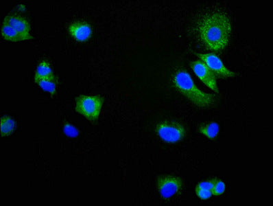 Immunofluorescence staining of MCF-7 cells with RAC07001 at 1:34,counter-stained with DAPI. The cells were fixed in 4% formaldehyde, permeabilized using 0.2% Triton X-100 and blocked in 10% normal Goat Serum. The cells were then incubated with the antibody overnight at 4?.The secondary antibody was Alexa Fluor 488-congugated AffiniPure Goat Anti-Rabbit IgG (H+L).