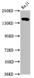 Western Blot; Positive WB detected in Raji whole cell lysate; All lanes CD21 antibody at 0.55Âµg/ml; Secondary; Goat polyclonal to rabbit IgG at 1/50000 dilution; Predicted band size: 155 KDa; Observed band size: 155 KDa;