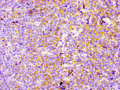 IHC image of CY5710 diluted at 1:100 and staining in paraffin-embedded human tonsil tissue performed on a Leica BondTM system. After dewaxing and hydration, antigen retrieval was mediated by high pressure in a citrate buffer (pH 6.0). Section was blocked with 10% normal goat serum 30min at RT. Then primary antibody (1% BSA) was incubated at 4? overnight. The primary is detected by a biotinylated secondary antibody and visualized using an HRP conjugated SP system.