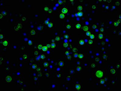 Immunofluorescence staining of Raji cells with RAC07002 at 1:34,counter-stained with DAPI. The cells were fixed in 4% formaldehyde, permeabilized using 0.2% Triton X-100 and blocked in 10% normal Goat Serum. The cells were then incubated with the antibody overnight at 4?.The secondary antibody was Alexa Fluor 488-congugated AffiniPure Goat Anti-Rabbit IgG (H+L).